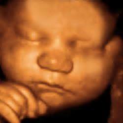 best time to do 3d ultrasound during pregnancy